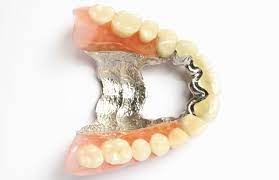 Sustainable Dentistry: Dental Scrap Recycling Benefits post thumbnail image